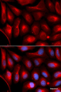 Immunofluorescence analysis of U2OS cells using PSMA5 Polyclonal Antibody