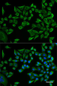 Immunofluorescence analysis of U2OS cells using WARS Polyclonal Antibody