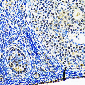 Immunohistochemistry of paraffin-embedded Rat ovary using p53 Polyclonal Antibody at dilution of 1:100 (40x lens) .
