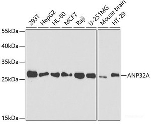 Western blot analysis of extracts of various cell lines using ANP32A Polyclonal Antibody at dilution of 1:1000.