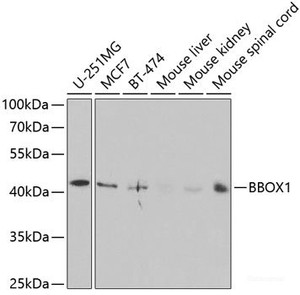 Western blot analysis of extracts of various cell lines using BBOX1 Polyclonal Antibody at dilution of 1:1000.