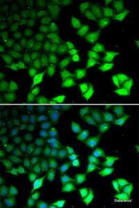 Immunofluorescence analysis of U2OS cells using KDM4B Polyclonal Antibody