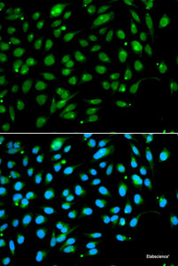 Immunofluorescence analysis of A549 cells using ING3 Polyclonal Antibody
