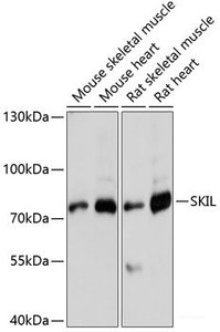 Western blot analysis of extracts of various cell lines using SKIL Polyclonal Antibody at dilution of 1:3000.