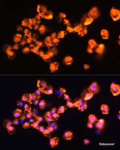 Immunofluorescence analysis of A431 cells using PRKCB Polyclonal Antibody at dilution of 1:100. Blue: DAPI for nuclear staining.