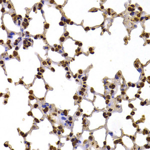 Immunohistochemistry of paraffin-embedded Mouse lung using FBXW7 Polyclonal Antibody at dilution of 1:100 (40x lens) .