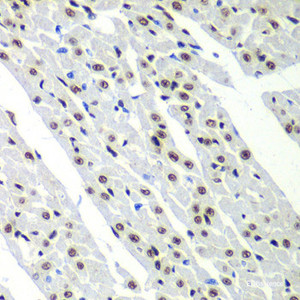 Immunohistochemistry of paraffin-embedded Rat heart using SF3B2 Polyclonal Antibody at dilution of 1:100 (40x lens) .