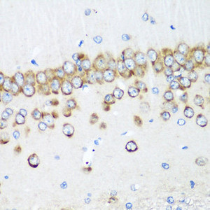 Immunohistochemistry of paraffin-embedded Rat brain using MTDH Polyclonal Antibody at dilution of 1:200 (40x lens) .