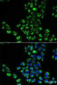 Immunofluorescence analysis of A549 cells using EIF5B Polyclonal Antibody