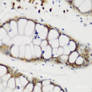 Immunohistochemistry of paraffin-embedded Human gastric using NCL Polyclonal Antibody at dilution of 1:200 (40x lens) .