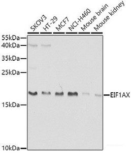 Western blot analysis of extracts of various cell lines using EIF1AX Polyclonal Antibody at dilution of 1:1000.