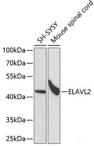 Western blot analysis of extracts of various cell lines using ELAVL2 Polyclonal Antibody at dilution of 1:1000.