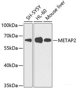 Western blot analysis of extracts of various cell lines using METAP2 Polyclonal Antibody at dilution of 1:1000.