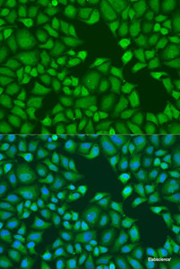 Immunofluorescence analysis of U2OS cells using TNRC6A Polyclonal Antibody at dilution of 1:100. Blue: DAPI for nuclear staining.