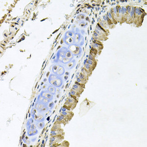 Immunohistochemistry of paraffin-embedded Mouse lung using ERBB4 Polyclonal Antibody at dilution of 1:100 (40x lens) .