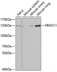 Western blot analysis of extracts of various cell lines using FBXO11 Polyclonal Antibody at dilution of 1:1000.