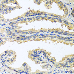 Immunohistochemistry of paraffin-embedded Human prostate using OSM Polyclonal Antibody at dilution of 1:100 (40x lens) .
