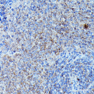 Immunohistochemistry of paraffin-embedded Rat spleen using CSF3 Polyclonal Antibody at dilution of 1:100 (40x lens) .