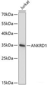 Western blot analysis of extracts of Jurkat cells using ANKRD1 Polyclonal Antibody at dilution of 1:1000.