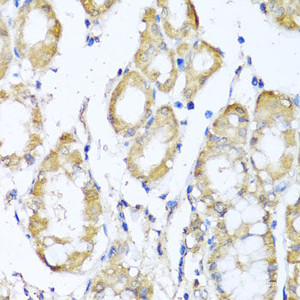 Immunohistochemistry of paraffin-embedded Human stomach using KCND2 Polyclonal Antibody at dilution of 1:100 (40x lens) .
