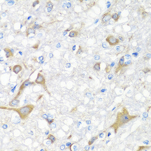 Immunohistochemistry of paraffin-embedded Rat brain using IL22 Polyclonal Antibody at dilution of 1:100 (40x lens) .