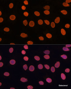 Immunofluorescence analysis of C6 cells using TADA3 Polyclonal Antibody at dilution of 1:100. Blue: DAPI for nuclear staining.