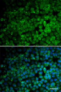 Immunofluorescence analysis of HeLa cells using TRIM13 Polyclonal Antibody