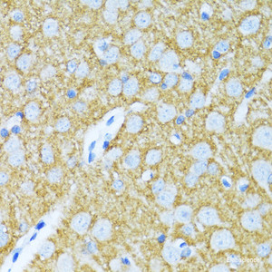 Immunohistochemistry of paraffin-embedded Rat brain using SYP Polyclonal Antibody at dilution of 1:100 (40x lens) .