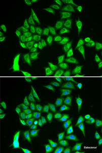 Immunofluorescence analysis of A549 cells using IREB2 Polyclonal Antibody