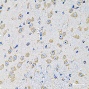 Immunohistochemistry of paraffin-embedded Mouse brain using MSRA Polyclonal Antibody at dilution of 1:100 (40x lens) .