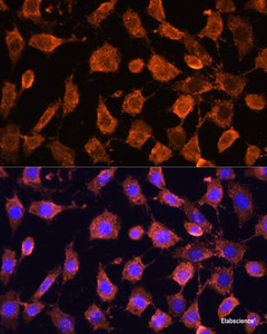 Immunofluorescence analysis of L929 cells using RPL11 Polyclonal Antibody at dilution of 1:100. Blue: DAPI for nuclear staining.