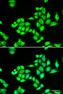 Immunofluorescence analysis of U2OS cells using TPD52L1 Polyclonal Antibody