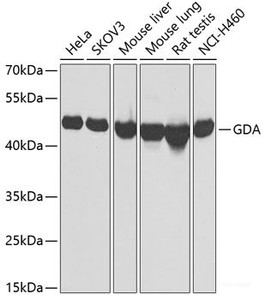 Western blot analysis of extracts of various cell lines using GDA Polyclonal Antibody at dilution of 1:1000.