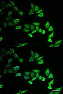 Immunofluorescence analysis of U2OS cells using MYOZ2 Polyclonal Antibody