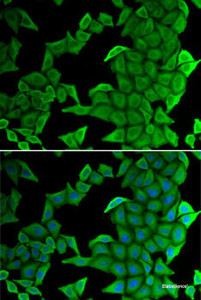 Immunofluorescence analysis of U2OS cells using SMYD2 Polyclonal Antibody