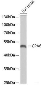 Western blot analysis of extracts of Rat testis using CPA6 Polyclonal Antibody at dilution of 1:1000.