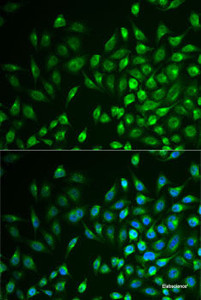 Immunofluorescence analysis of U2OS cells using LNX1 Polyclonal Antibody