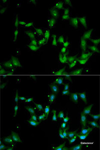 Immunofluorescence analysis of MCF7 cells using IL17F Polyclonal Antibody