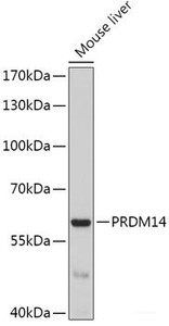 Western blot analysis of extracts of Mouse liver using PRDM14 Polyclonal Antibody at dilution of 1:1000.