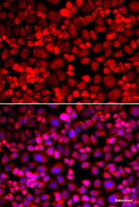 Immunofluorescence analysis of A549 cells using ANLN Polyclonal Antibody