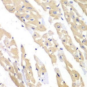 Immunohistochemistry of paraffin-embedded Mouse heart using CCT3 Polyclonal Antibody at dilution of 1:100 (40x lens) .