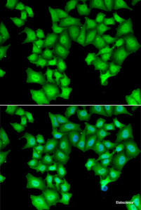 Immunofluorescence analysis of HeLa cells using CPSF3L Polyclonal Antibody