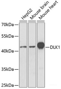 Western blot analysis of extracts of various cell lines using DLK1 Polyclonal Antibody at dilution of 1:1000.