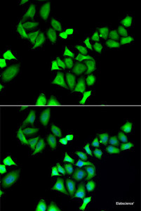 Immunofluorescence analysis of A549 cells using GALE Polyclonal Antibody