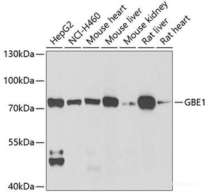 Western blot analysis of extracts of various cell lines using GBE1 Polyclonal Antibody at dilution of 1:1000.