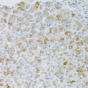 Immunohistochemistry of paraffin-embedded Mouse stomach using HPS1 Polyclonal Antibody at dilution of 1:100 (40x lens) .