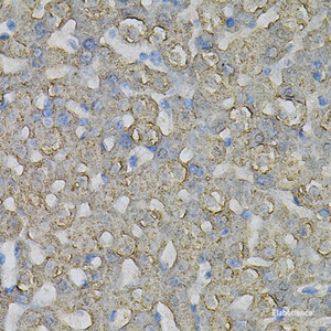 Immunohistochemistry of paraffin-embedded Rat liver using INPP5J Polyclonal Antibody at dilution of 1:100 (40x lens) .