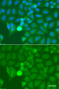 Immunofluorescence analysis of A549 cells using IRAK2 Polyclonal Antibody