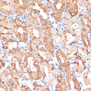 Immunohistochemistry of paraffin-embedded Human stomach using NHLRC1 Polyclonal Antibody at dilution of 1:100 (40x lens) .
