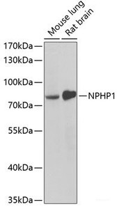 Western blot analysis of extracts of various cell lines using NPHP1 Polyclonal Antibody at dilution of 1:1000.